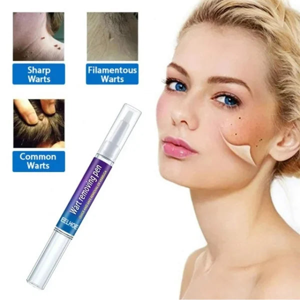 Warts Remover Original Cream