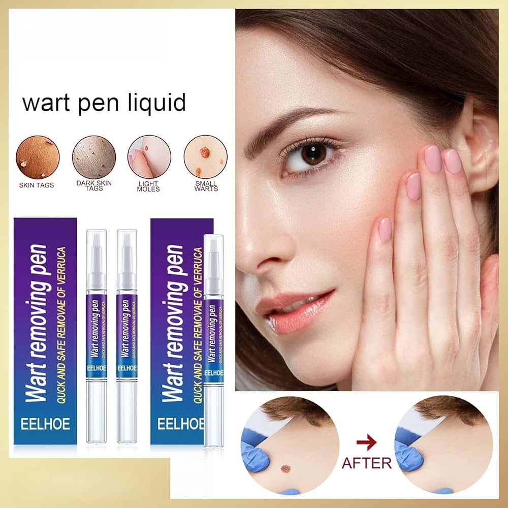 Warts Remover Original Cream