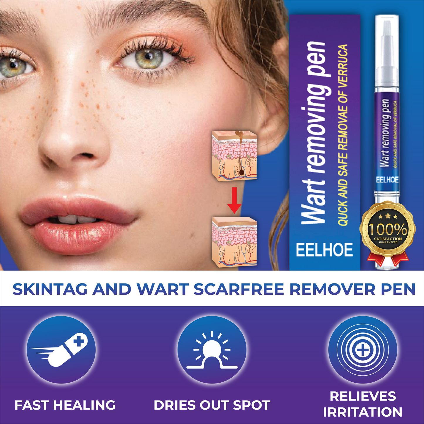 Warts Remover Original Cream