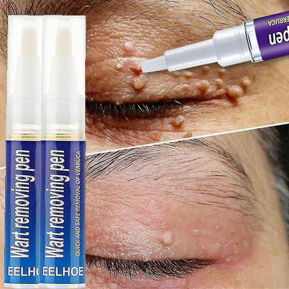 Warts Remover Original Cream